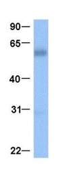 Anti-NKX2.8 antibody used in Western Blot (WB). GTX04864