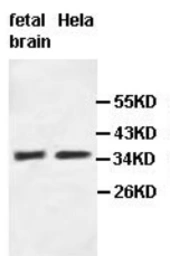 Anti-OPCML antibody used in Western Blot (WB). GTX04867