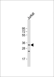 Anti-KLRC1 antibody used in Western Blot (WB). GTX04876