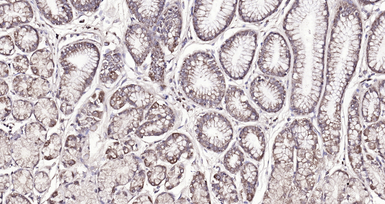 Anti-Amphiregulin antibody used in IHC (Paraffin sections) (IHC-P). GTX04890
