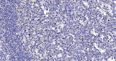 Anti-Amphiregulin antibody used in IHC (Paraffin sections) (IHC-P). GTX04890