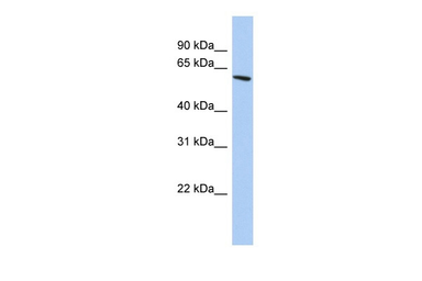 Anti-ZNF567 antibody used in Western Blot (WB). GTX04900