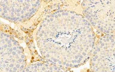 Anti-xCT / SLC7A11 antibody used in IHC (Paraffin sections) (IHC-P). GTX04911