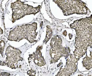 Anti-TIF1 alpha antibody [4G6C2] used in IHC (Paraffin sections) (IHC-P). GTX04912