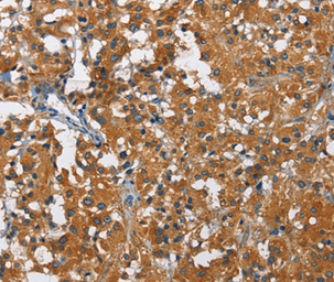 Anti-KLF7 antibody used in IHC (Paraffin sections) (IHC-P). GTX04926