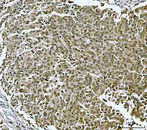 Anti-Twist1/2 antibody used in IHC (Paraffin sections) (IHC-P). GTX04942