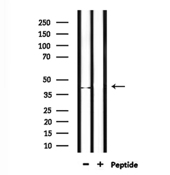 Anti-NEIL2 antibody used in Western Blot (WB). GTX04947