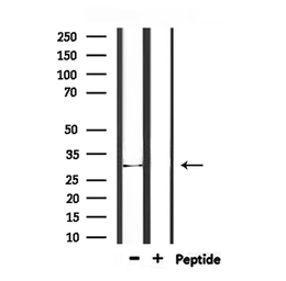Anti-Midline-1 antibody used in Western Blot (WB). GTX04955