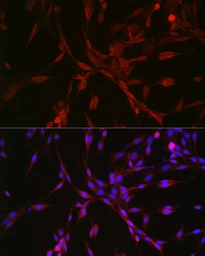 Anti-GATSL3 antibody used in Immunocytochemistry/ Immunofluorescence (ICC/IF). GTX04958