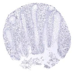 Anti-TFE3 antibody [MSVA-403R] HistoMAX&trade; used in IHC (Paraffin sections) (IHC-P). GTX04963