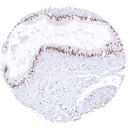 Anti-TFE3 antibody [MSVA-403R] HistoMAX&trade; used in IHC (Paraffin sections) (IHC-P). GTX04963