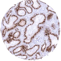 Anti-Prostein antibody [MSVA-460R] HistoMAX&trade; used in IHC (Paraffin sections) (IHC-P). GTX04965