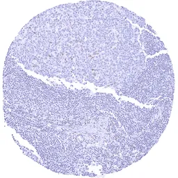 Anti-TLE1 antibody [MSVA-856R] HistoMAX&trade; used in IHC (Paraffin sections) (IHC-P). GTX04966