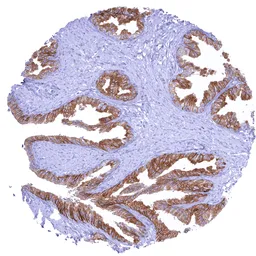 Anti-CD38 antibody [MSVA-038R] HistoMAX&trade; used in IHC (Paraffin sections) (IHC-P). GTX04967