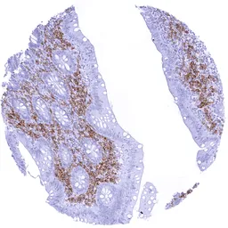 Anti-CD38 antibody [MSVA-038R] HistoMAX&trade; used in IHC (Paraffin sections) (IHC-P). GTX04967