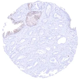 Anti-CD38 antibody [MSVA-038R] HistoMAX&trade; used in IHC (Paraffin sections) (IHC-P). GTX04967