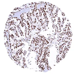 Anti-Cyclin E1 antibody [MSVA-898R] HistoMAX&trade; used in IHC (Paraffin sections) (IHC-P). GTX04969