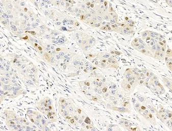 Anti-Anillin antibody used in IHC (Paraffin sections) (IHC-P). GTX04983
