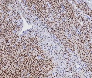 Anti-FOXL2 antibody [FOXL2/7989R] used in IHC (Paraffin sections) (IHC-P). GTX05010