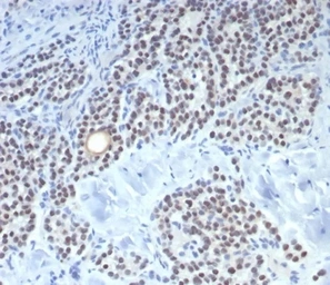 Anti-FOXL2 antibody [FOXL2/7989R] used in IHC (Paraffin sections) (IHC-P). GTX05010