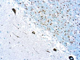 Anti-Trk antibody used in IHC (Paraffin sections) (IHC-P). GTX05014