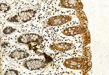 Anti-IRE1 alpha (phospho Ser724) antibody used in IHC (Paraffin sections) (IHC-P). GTX05026