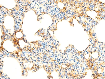 Anti-IKB alpha (phospho Ser32/Ser36) antibody used in IHC (Paraffin sections) (IHC-P). GTX05029