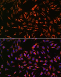 Anti-EML4 antibody used in Immunocytochemistry/ Immunofluorescence (ICC/IF). GTX05051
