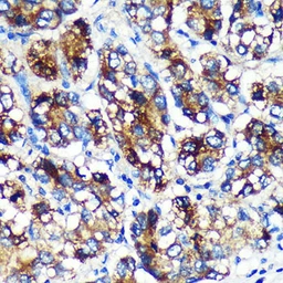 Anti-EML4 antibody used in IHC (Paraffin sections) (IHC-P). GTX05051