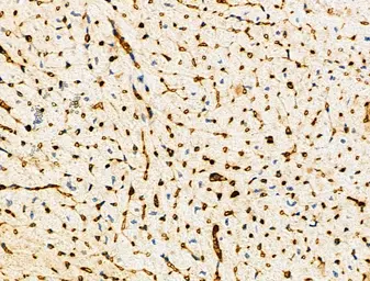 Anti-TREM1 antibody used in IHC (Paraffin sections) (IHC-P). GTX05054