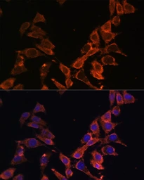 Anti-ND4 antibody used in Immunocytochemistry/ Immunofluorescence (ICC/IF). GTX05068