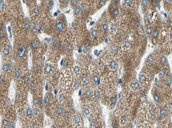 Anti-MMP11 antibody used in IHC (Paraffin sections) (IHC-P). GTX05076