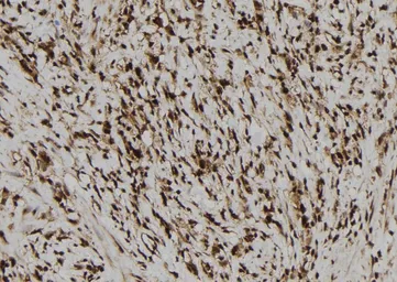 Anti-NLRP3 antibody used in IHC (Paraffin sections) (IHC-P). GTX05106