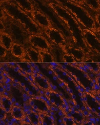 Anti-Laminin gamma 2 antibody used in IHC (Paraffin sections) (IHC-P). GTX05124