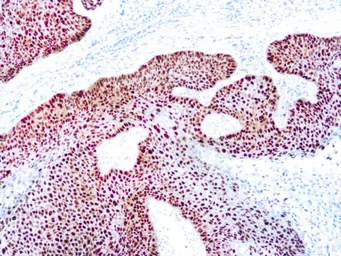 Anti-p63 antibody [DBR16.1] (ready-to-use) used in IHC (Paraffin sections) (IHC-P). GTX05134