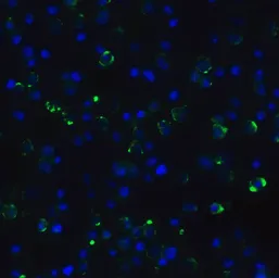 Anti-CDKN2A / p16INK4a antibody used in Immunocytochemistry/ Immunofluorescence (ICC/IF). GTX05147