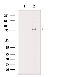 Anti-DRP1 antibody used in Western Blot (WB). GTX05148