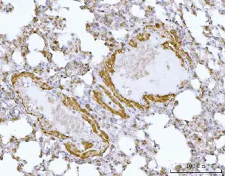 Anti-HBEGF antibody used in IHC (Paraffin sections) (IHC-P). GTX05154