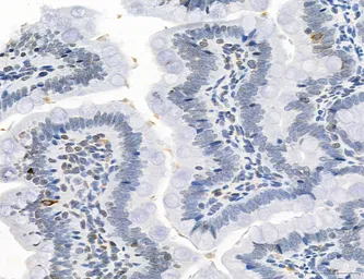 Anti-NEU4 antibody used in IHC (Paraffin sections) (IHC-P). GTX05156