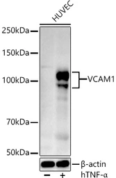Anti-VCAM1 / CD106 antibody used in Western Blot (WB). GTX05159