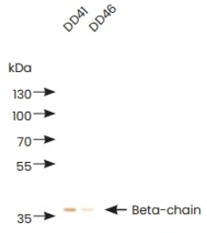 Anti-D-Dimer antibody [DD41] used in  (). GTX05174