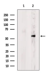 Anti-POMGNT1 antibody used in Western Blot (WB). GTX05196