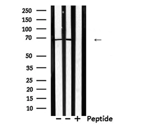 Anti-DDX5 antibody used in Western Blot (WB). GTX05200