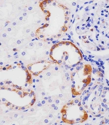 Anti-HHLA2 antibody used in IHC (Paraffin sections) (IHC-P). GTX05203