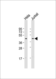 Anti-FBXO32 antibody used in Western Blot (WB). GTX05208