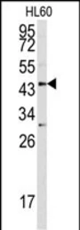 Anti-Asporin antibody used in Western Blot (WB). GTX05210