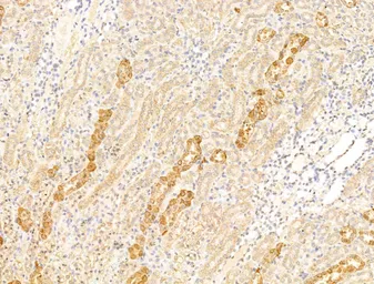 Anti-Asporin antibody used in IHC (Paraffin sections) (IHC-P). GTX05211