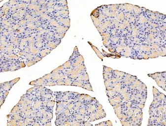 Anti-Asporin antibody used in IHC (Paraffin sections) (IHC-P). GTX05211
