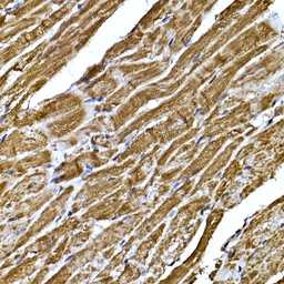 Anti-BNP / proBNP antibody used in IHC (Paraffin sections) (IHC-P). GTX05212