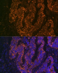 Anti-CEACAM6 antibody [ARC2110] used in IHC (Paraffin sections) (IHC-P). GTX05214